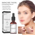 thumbnail image 4 of Suero corrector de manchas oscuras suero eliminador de melasma iluminador seguro hidratante suave para el hogar para el cuidado de la piel ANGGREK Otros, 4 of 8