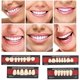 thumbnail image 3 of Dental Material Synthetic Resin False Teeth Filling Denture Tooth Care Tool Temporary Repair White Teeth Cosmetic Dentures For Upper Jaw, 3 of 5