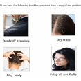 thumbnail image 2 of czcpp-Dandruff Comb,Hollow Tooth Lice Comb,Scalp Comb for Dandruff Removal,Hollow Tooth Comb for Better Hair Quality for Women Men (One Size, count, 2), 2 of 4