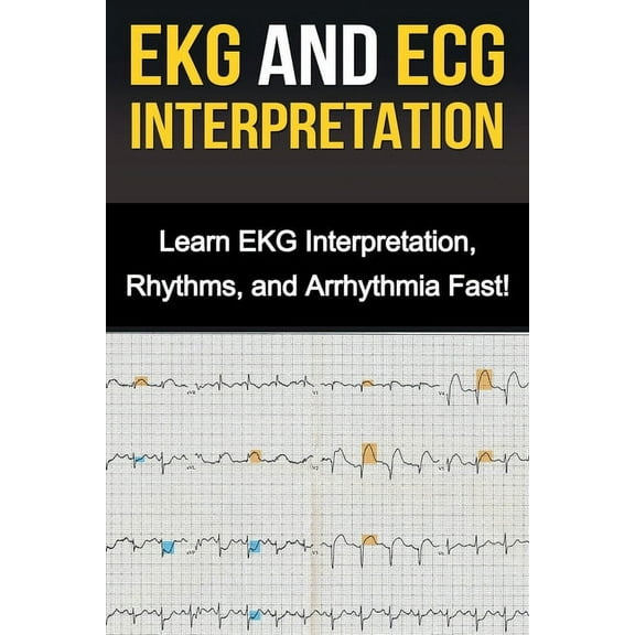 EKG and ECG Interpretation: Learn EKG Interpretation, Rhythms, and Arrhythmia Fast!, (Paperback)
