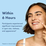 Rael Miracle Patch Advanced Strength Retinol Spot Cover, for Stubborn Pimples, 24 Count
