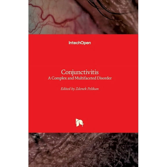 Conjunctivitis: A Complex and Multifaceted Disorder (Hardcover)