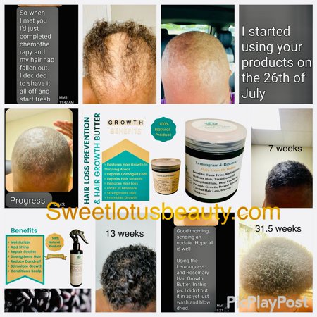 Hair Loss Prevention & Hair Growth Butter