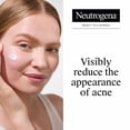 thumbnail image 3 of Neutrogena Rapid Clear Acne Spot Treatment, Benzoyl Peroxide 10% Pimple Cream, 1 oz, 3 of 10