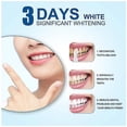 thumbnail image 3 of Dientes Blanqueamiento Dental Pluma de Gel Blanqueamiento Blanco Blanqueador Dental Dientes Blancos, 3 of 4