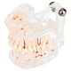 thumbnail image 2 of Modelo de dentista, nuevo estudio de enseñanza dental, modelo de educación dental, suministros dentales, características mejoradas, 2 of 14
