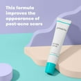 thumbnail image 5 of Proactiv Post Acne Scar Treatment Gel, Resurfaces Skin & Smooths Rough Texture, 1 Fl Oz, 5 of 8