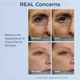 thumbnail image 5 of PlexadmRapid Reduction Eye Serum 5 ML Advanced Formula Anti Aging Eye Serum Reduces Under Eye Bags Wrinkles Dark Circles Fine Lines Crow's Feet Instantly Instant Wrinkle Remover for Youthful Look, 5 of 8