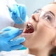 thumbnail image 5 of Herramientas de limpieza de dientes Removedor de acero inoxidable Remoción de cálculo Scraper Lavable Reutilizable MANUAL MANUAL DIOSTROS Dientes Pinzas Tweeer 5pcs Inevent CE001731-03B, 5 of 7
