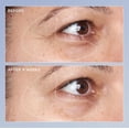 thumbnail image 3 of Sérum para ojos Perricone MD de alta potencia con triple retinol, 15 ml, 3 of 4