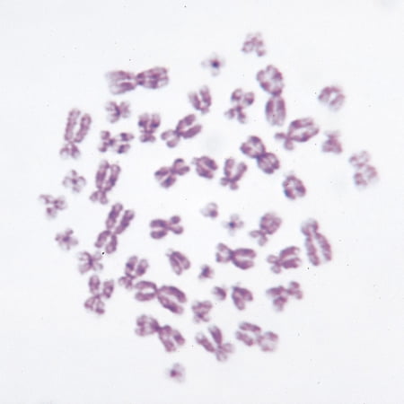 Human Female Chromosomes - 46, Xx, Spread Microscope Slide