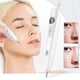 thumbnail image 2 of Portable Electric Remover Tool For Face And Body, Skin Removal Girls & Women, Ideal Gift Blue Light Remover Pen, Electronic Face Skin Removal Pen Repa, 2 of 5