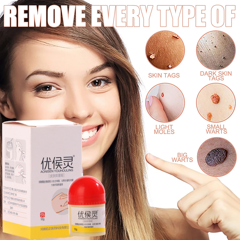 Piece Body Warts Treatment Cream Skin Tag Remover Foot Corn Removal