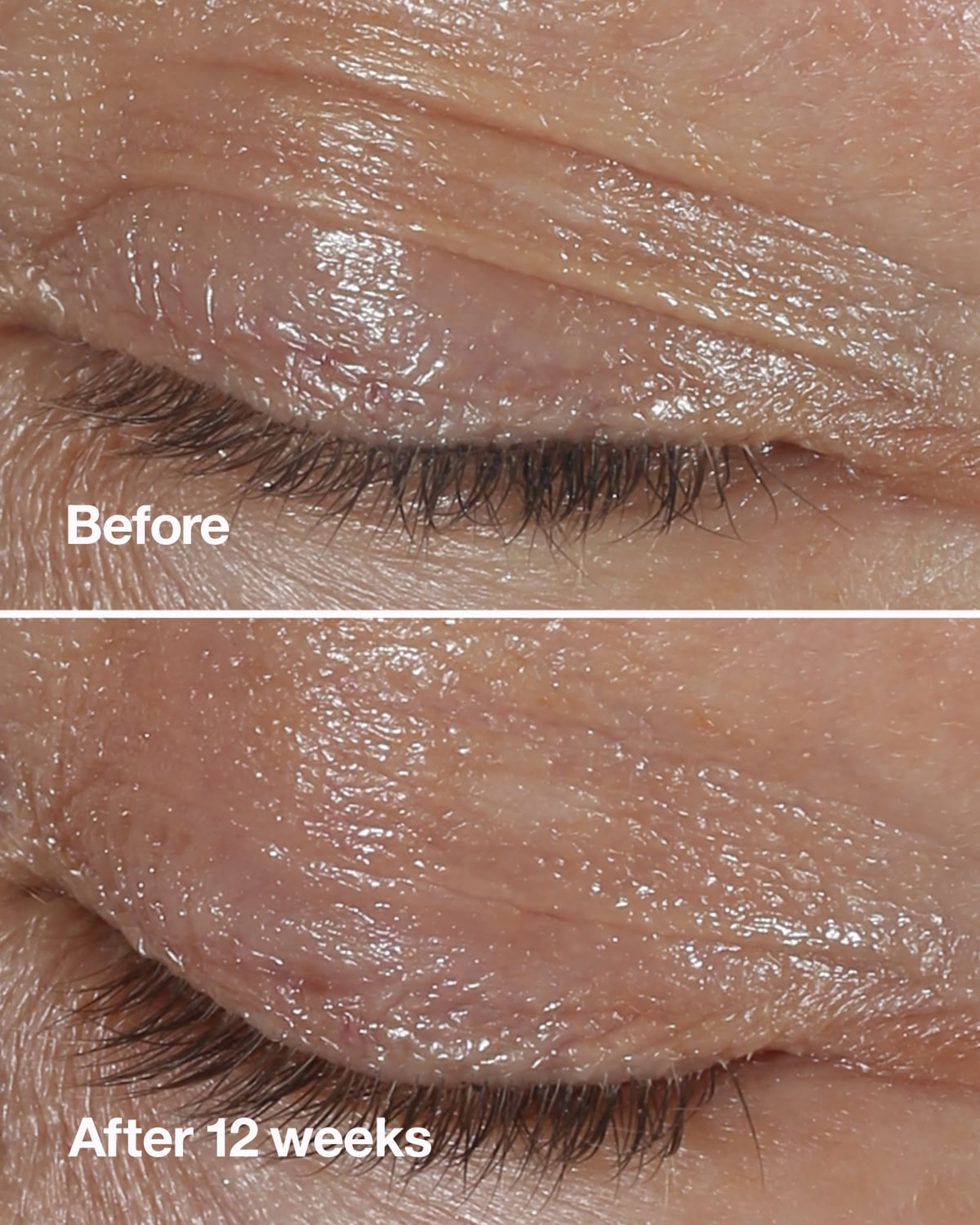 CLINIQUE Smart Clinical Repair Wrinkle Correcting Eye Cream, 15ml/0.5oz, Unboxed