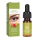 thumbnail image 1 of Aceite esencial reafirmante para la piel de los ojos, aceite esencial nutritivo para aliviar el edema de líneas finas y ojeras, 10ml, 1 of 8
