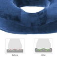 thumbnail image 5 of Uanit Donut Pillow Seat Cushion for Tailbone Pain Relief, Back, Hip Pain, Hemorrhoids, Post Surgery, Postpartum Pregnancy, Office Desk Chair, Wheelchair, Travel, Medium Firmness Supports, 5 of 6
