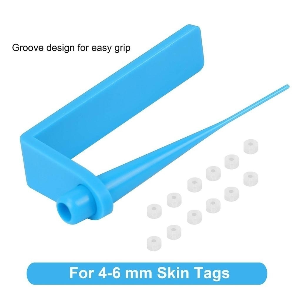 Micro Skin Tag Remover Kit For Home Use Small to Medium Skin Tags Body