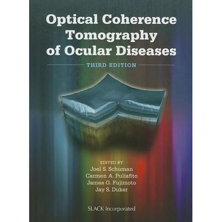 UPC: 9781556428647 | Optical Coherence Tomography of Ocular Diseases (Edition 3) (Hardcover)