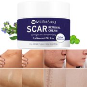 MURASAKI Scar Removal Cream, Scar Treatment - Stretch Marks Remover Cream for All Skin Types, New and Old Scar - 1 oz. / 30g