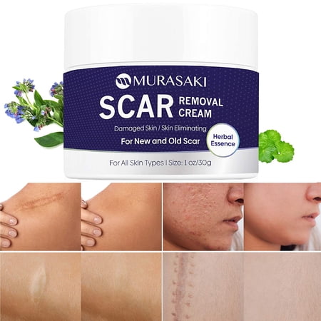 MURASAKI Scar Removal Cream, Scar Treatment - Stretch Marks Remover Cream for All Skin Types, New and Old Scar - 1 oz. / 30g