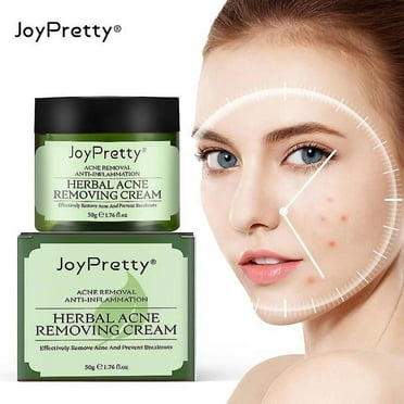 Joypretty Herbal Day Cream For Acne Skin Care Face Moisturizer