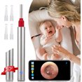 thumbnail image 1 of Ear Wax Remover,Wireless Otoscope Earwax Removal Tool 1080P HD WiFi Ear Endoscope with LED Light,3.5mm Visual Ear Scope Camera Safe Ear Pick Ear Cleaning Endocsope Kit for Adults Kids & Pets, 1 of 7