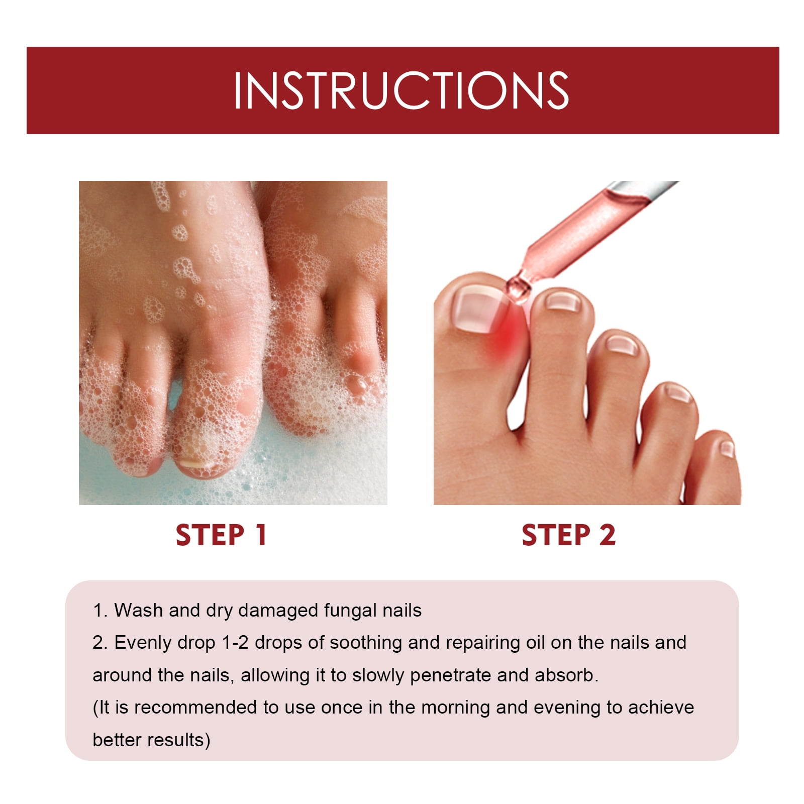 Alvantor Ingrown Toenail Treatment, Pain Relief and Nail Care for Ingrown Corrector and Fungus Treatment, 0.34fl.oz