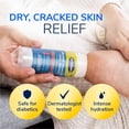 thumbnail image 6 of Dr. Scholl's Cracked Heel Repair Balm (2.5oz) 25% Urea. Heals and Moisturizes feet, 6 of 20