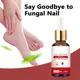 thumbnail image 5 of Tratamiento de hongos para uñas, suero esencial para la eliminación de hongos en los pies, onicomicosi, productos para el cuidado antiinfección, 5 of 5