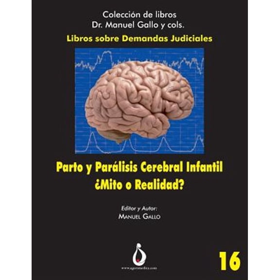 Pre-Owned Libros Dr. Manuel Gallo: Parto Y Parlisis Cerebral Infantil. mito O Realidad? : Una Relacin Cada Vez Menos Posible (Series #16) (Paperback)