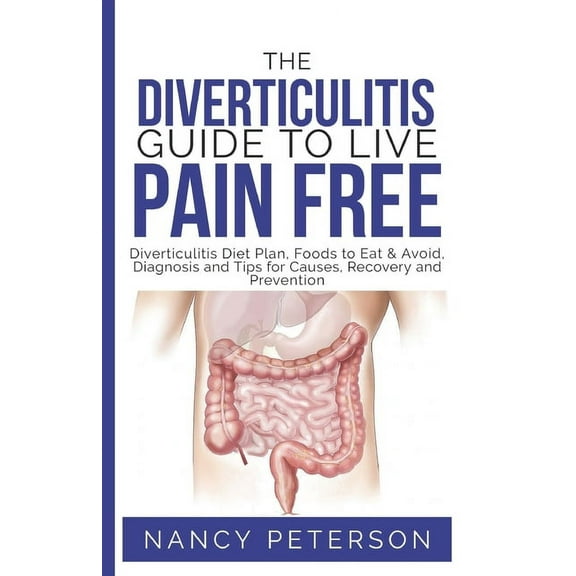 The Diverticulitis Guide to Live Pain Free, (Paperback)