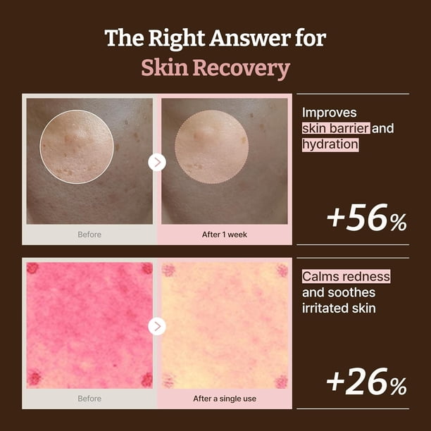Dr. Reju-All Advanced PDRN Rejuvenating Cream – 99% Pure Salmon