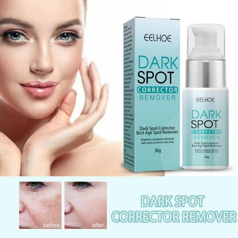 Best Black Spot Removal Cream