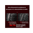 thumbnail image 4 of Cepillo Masajeador Inteligente Con Terapia De Luz Y Esencia Xtellar Rojo, 4 of 4