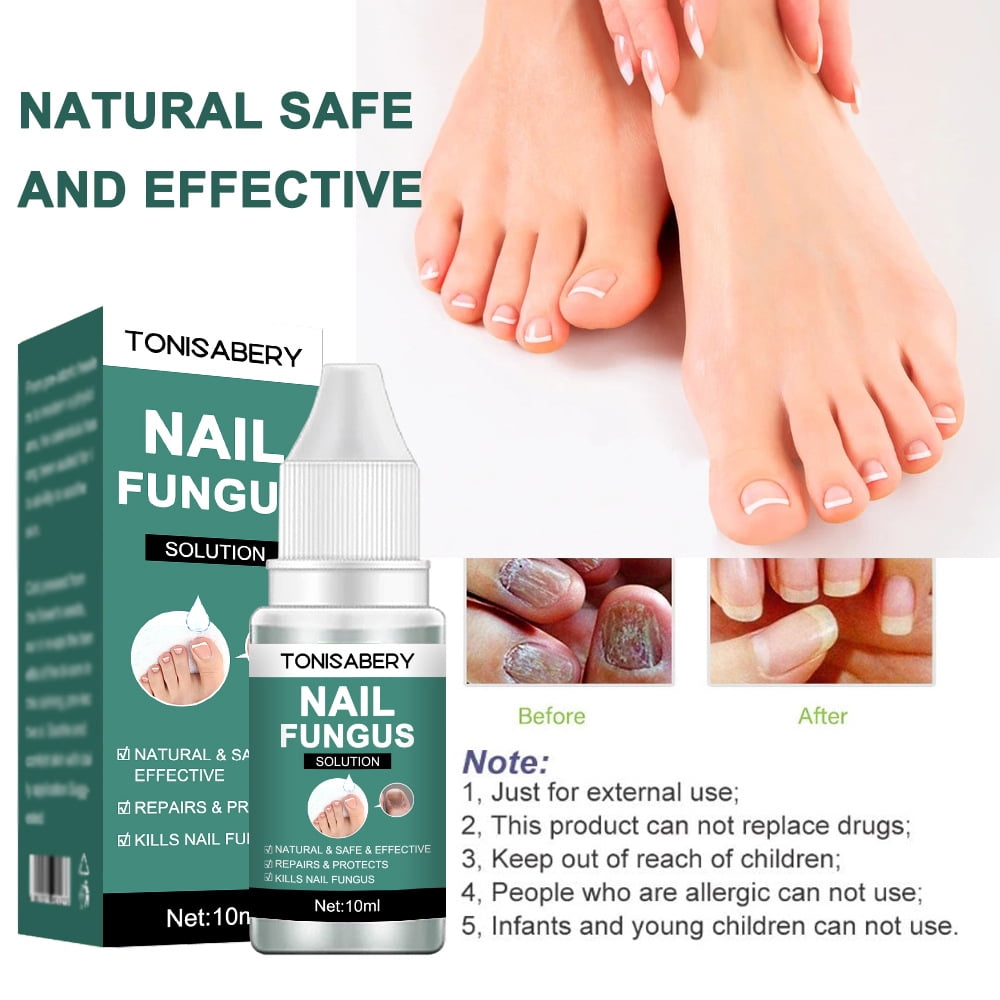 Nail Fungal Treatment Feet Care Essence Anti Infection Paronychia