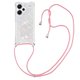 thumbnail image 2 of Funda FOXDOCK para Xiaomi Redmi Note 13 Pro Plus con Cuerda Ajustable, Brillo Líquido, Protección Antigolpes y Lente – Ideal para Regalo, 2 of 6