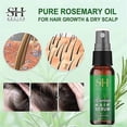 thumbnail image 2 of Aceite de romero para el crecimiento del cabello, nutre el cuero cabelludo, fortalece el cabello y estimula su crecimiento, elimina la picazón y la sequedad del cuero cabelludo (30-90 ml) 60 ml, 2 of 5