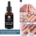 thumbnail image 3 of Gel Polish Remover Nails nail toe Nail 50ml, 3 of 8