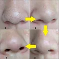 thumbnail image 4 of Mascarilla Unisex para quitar espinillas, tiras nasales, Limpieza Profunda, retráctil de poros, pegatinas negras para el cuidado de la piel, 4 of 5