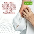 thumbnail image 3 of Medline Remedy Essentials Antifungal Cream with Zinc Oxide, 4 oz., 12 Count, 3 of 6