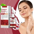 thumbnail image 1 of Essence Dragon's Blood Facial Dragon Blood Anti-Âge Set Dragon Blood Set (30ml), 1 of 9