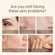 thumbnail image 2 of Disaar-crema facial con vitamina C, blanqueamiento profundo, manchas de arrugas, acné, antipecas, ilumina la cara, 50g"Face Cream" Fivean LED, 2 of 2