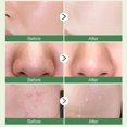 thumbnail image 5 of Green Tea Mask Stick Blackhead Remover Face Mask Clay Mask Purifying Oil Control Clean Solid Mask Moisturizing Acne Deep Pore Cleansing For All Skin T, 5 of 5