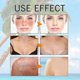 thumbnail image 5 of 1-5Pcs Hyaluronic Acid Watery Sun Gel Sunscreen 50ml Spf50+ Pa++++, 5 of 5