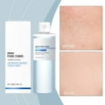 thumbnail image 4 of Moisturizing Toner Hydrating Nourishing Care Antiwrinkle Moisturizing Refreshing Facial Water 100ml, 4 of 9