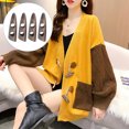 thumbnail image 1 of OULII 50Pcs Clothes Horn Buttons for Suits and Coats in Vintage Style, 1 of 4