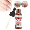 thumbnail image 1 of Reparación De Hongos En Las Uñas, Tratamiento De Hongos En Las Uñas, Solución De Cuidado De La Salud Para Hongos En Las Uñas De Los Pies Y Pies De Atleta, 1 of 7