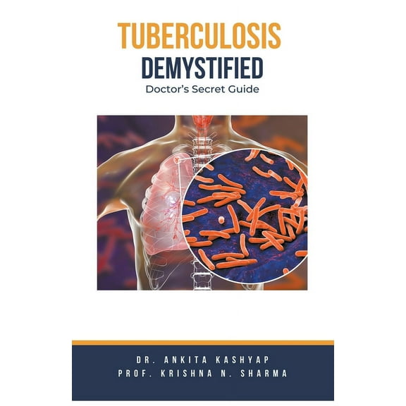Tuberculosis Demystified: Doctor's Secret Guide, (Paperback)