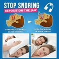 thumbnail image 6 of Tooth care Bruxism Guard Grinding Teeth Protector Night Mouth Sleep Tooth 1/2PC, 6 of 9