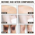 thumbnail image 5 of Exfoliante corporal con café Jaysuing, limpieza profunda, exfoliación y rejuvenecimiento de la piel, elimina la melanina y aclara la piel -8230378999619, 5 of 5